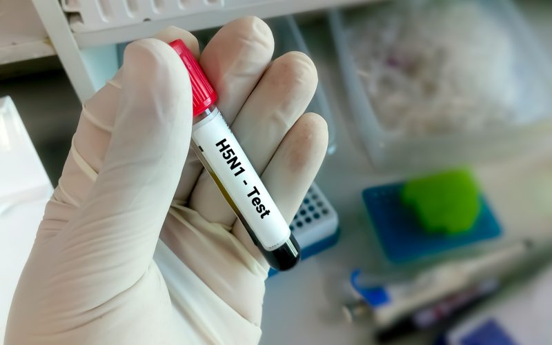 اكتشاف أول حالة إصابة بشرية بإنفلونزا الطيور في إحدى الدول الآسيوية.. تفاصيل